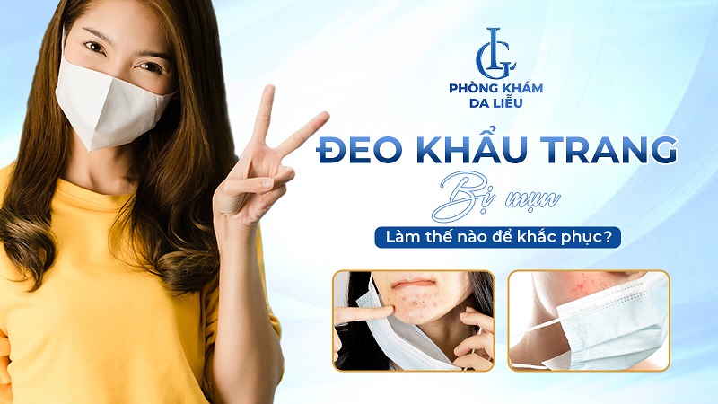 Đeo khẩu trang nhiều có bị mụn không?