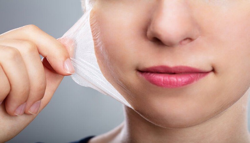 chăm sóc da sau peel mụn