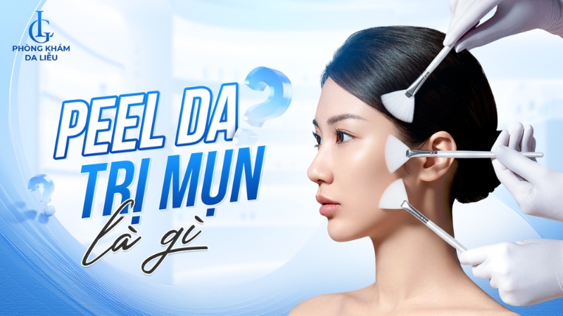 Peel da trị mụn là gì?