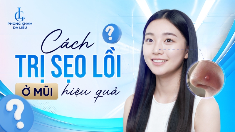 Sẹo lồi ở mũi