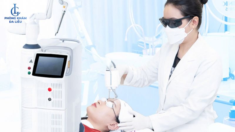 Laser CO2 trị sẹo rỗ nhẹ