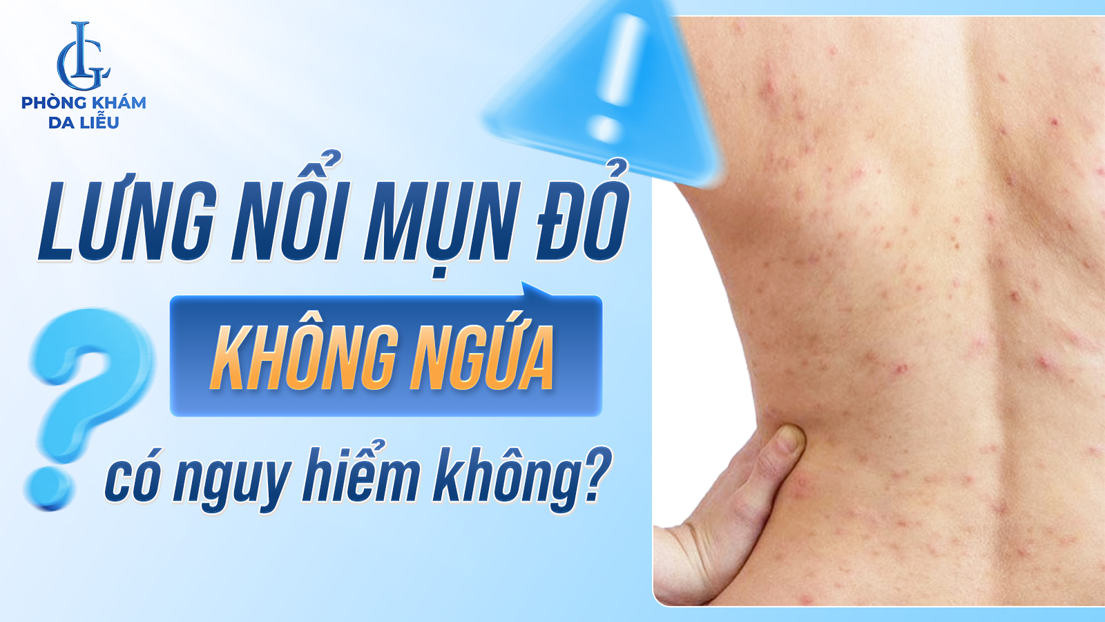 Lưng nổi mụn đỏ không ngứa nguy hiểm không