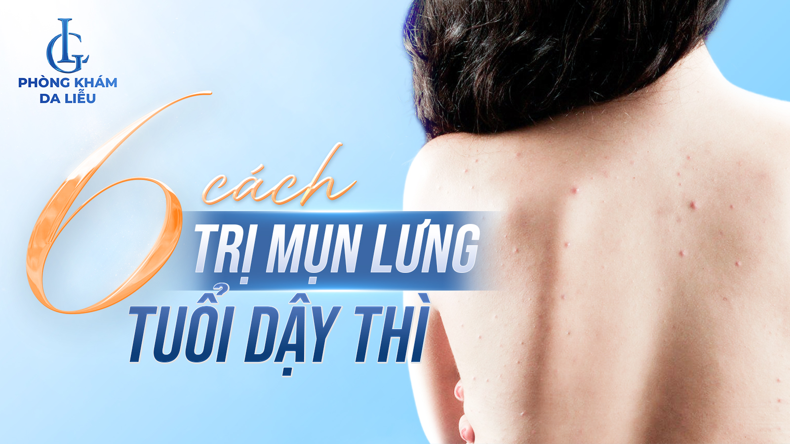 cách trị mụn lưng tuổi dậy thì