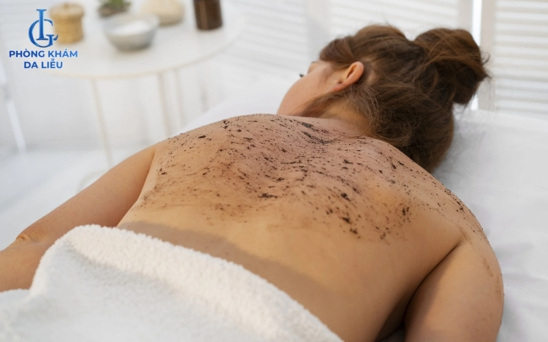 cách trị mụn lưng tuổi dậy thì bằng tẩy tế bào chết