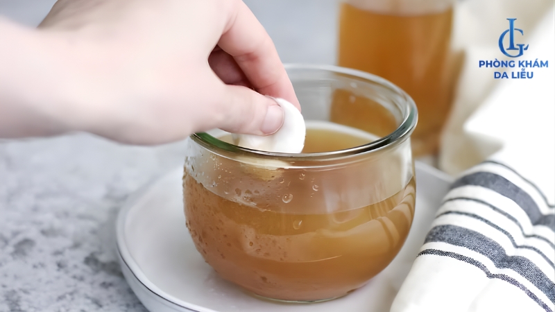 cách trị mụn lưng tuổi dậy thì