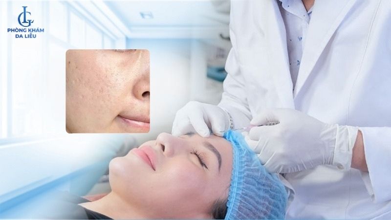 phòng khám cắt đáy sẹo rỗ