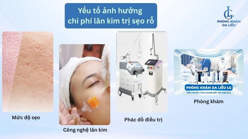 chi phí lăn kim trị sẹo