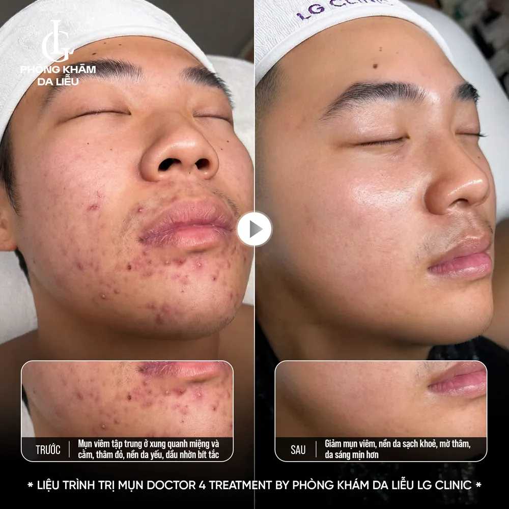 Hình ảnh ba doctor 4 treatment
