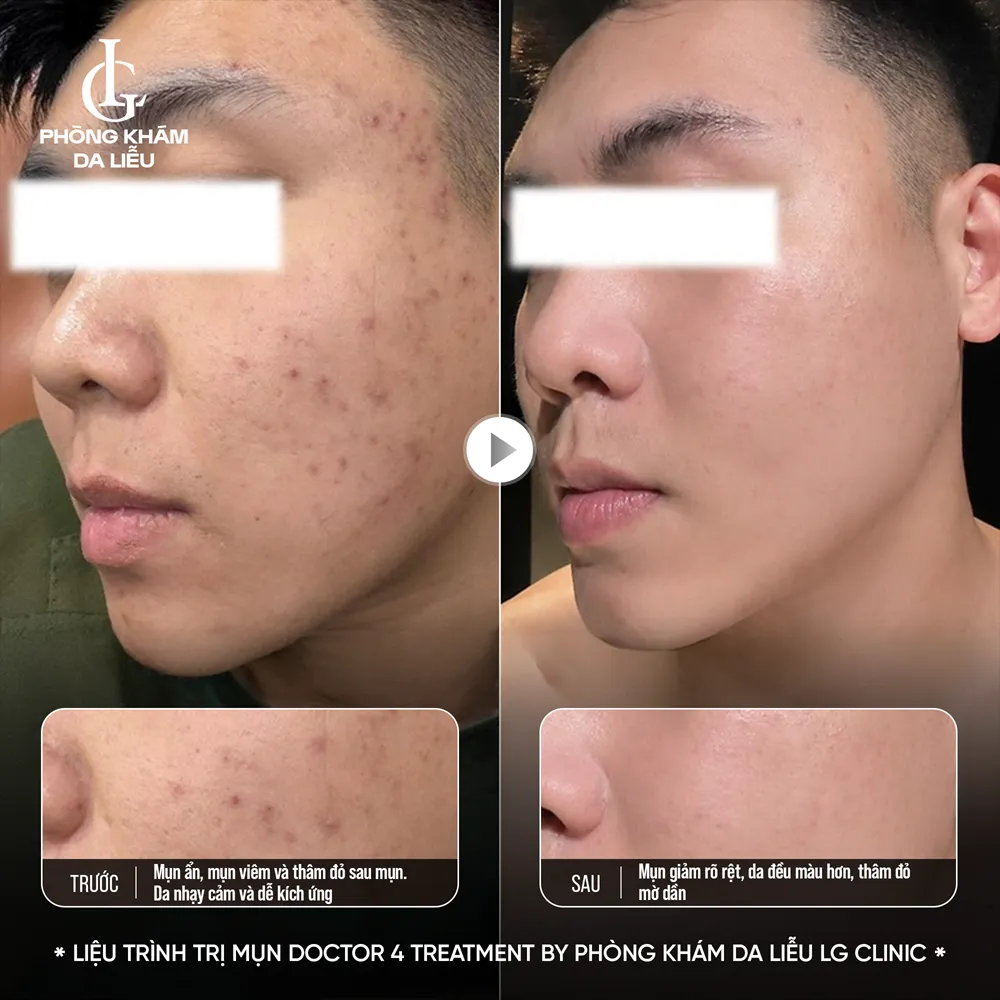 Hình ảnh ba doctor 4 treatment