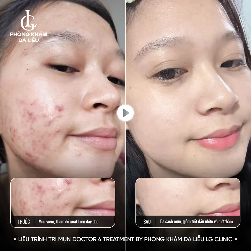 Hình ảnh ba doctor 4 treatment