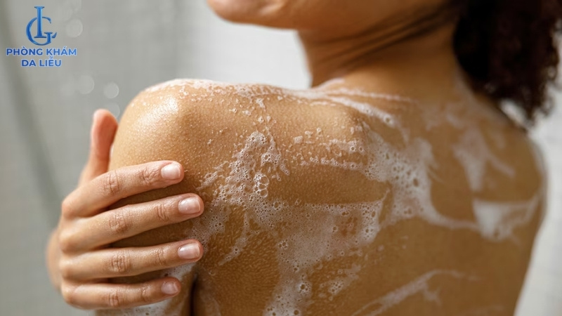 làm sạch da cải thiện tình trạng mụn ở ngực và lưng