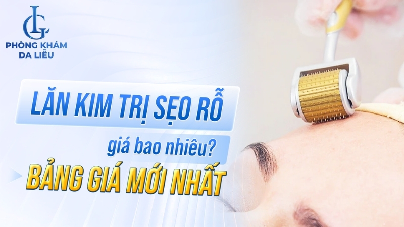 lăn kim trị sẹo rỗ giá bao nhiêu