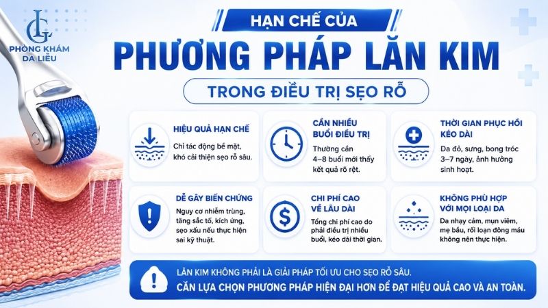 Hạn chế của lăn kim trị sẹo rỗ