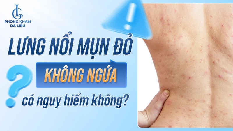 lưng nổi mụn đỏ