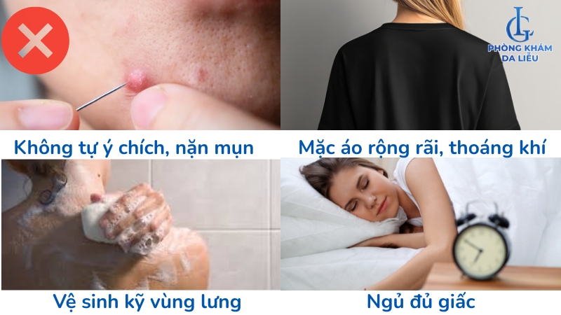 ngừa mụn bọc ở lưng