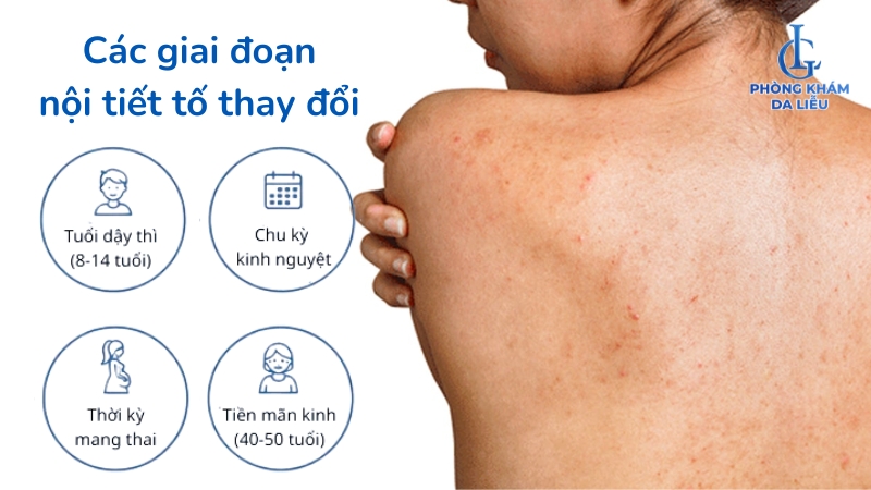 nổi mụn ở lưng và vai