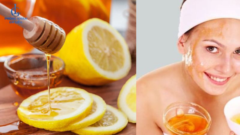 Mật ong và chanh