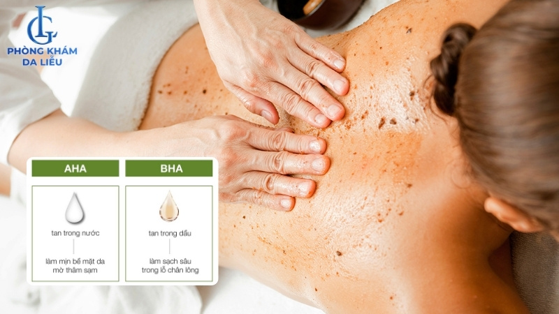 tẩy tế bào chết điều trị mụn lưng