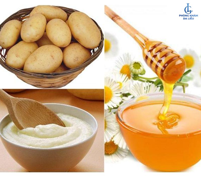 Khoai tây và mật ong