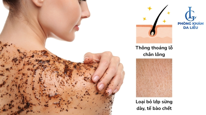 tẩy tế bào chết trị thâm mụn lưng