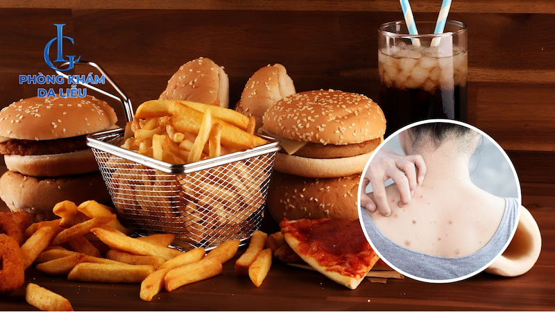 vì sao ăn uống ảnh hưởng mụn lưng