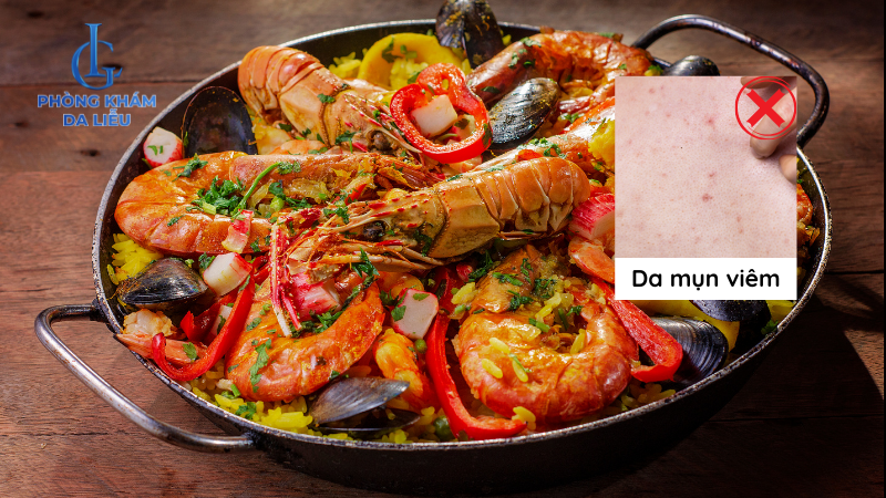 một số hải sản gây viêm