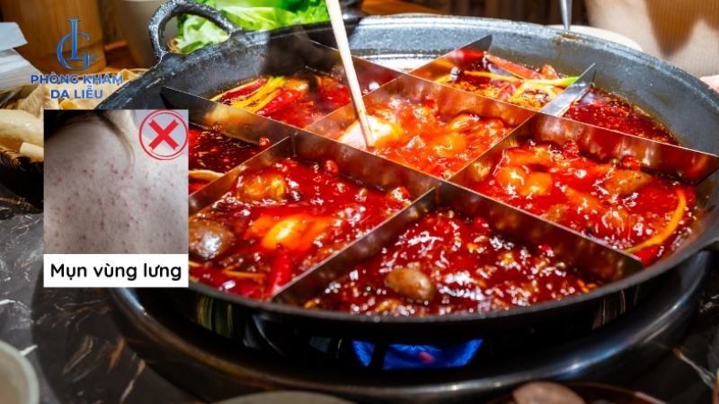 bị mụn lưng nên kiêng ăn gì