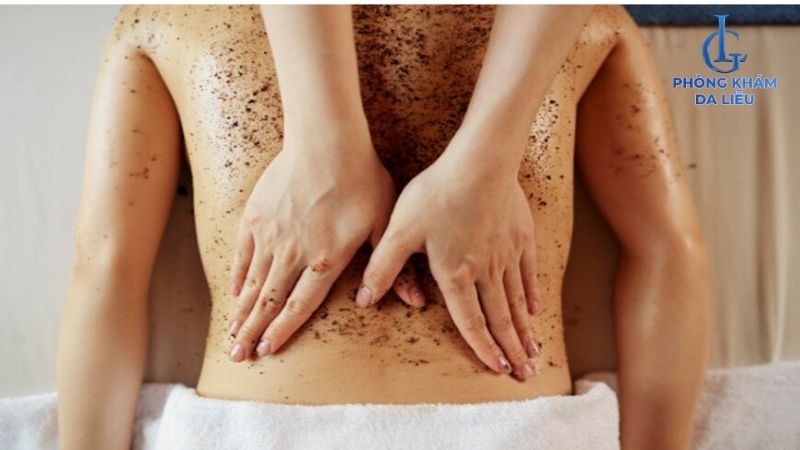 tẩy tế bào chết mụn lưng