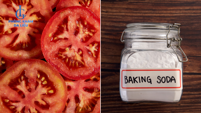 baking soda và cà chua giảm nhờn
