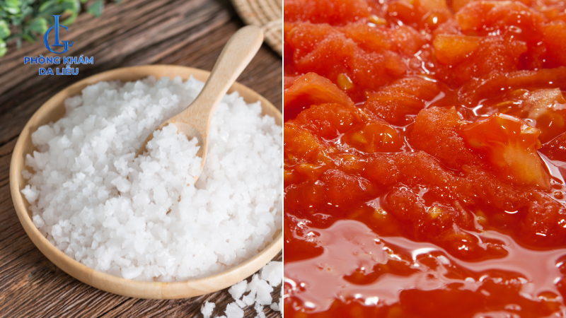 cà chua và muối trị mụn lưng