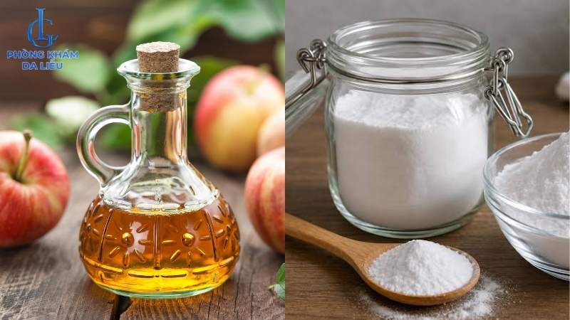 cách trị mụn lưng bằng giấm táo và baking soda