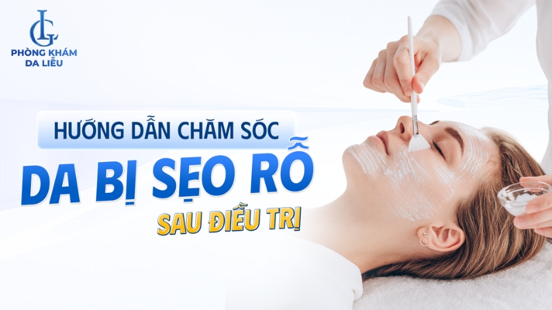 chăm sóc da bị sẹo rỗ sau điều trị