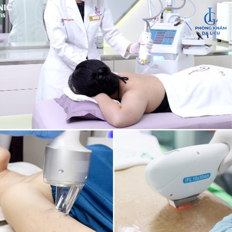 phòng khám điều trị viêm nang lông