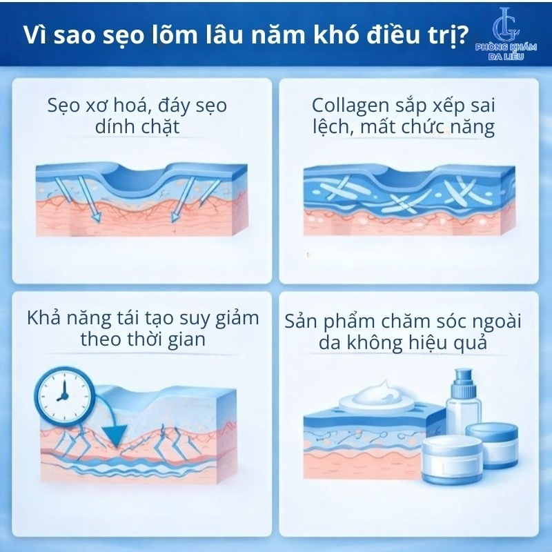 điều trị sẹo lõm lâu năm