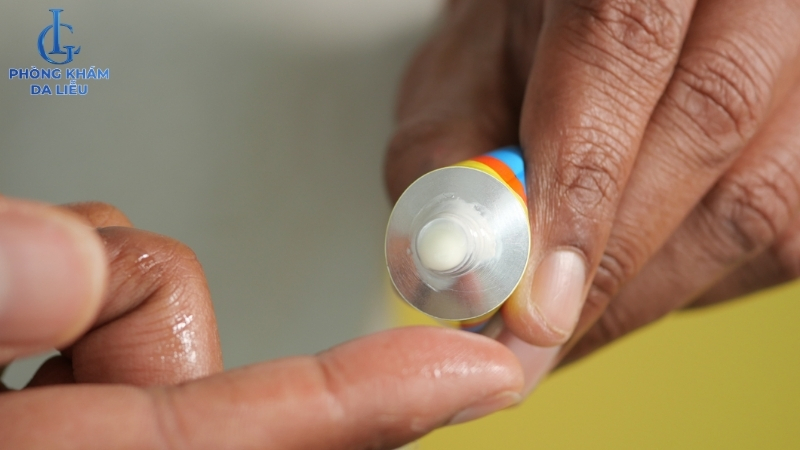 điều trị viêm nang lông bằng thuốc bôi