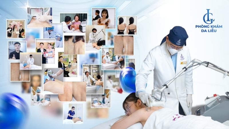 điều trị viêm nang lông ở tay