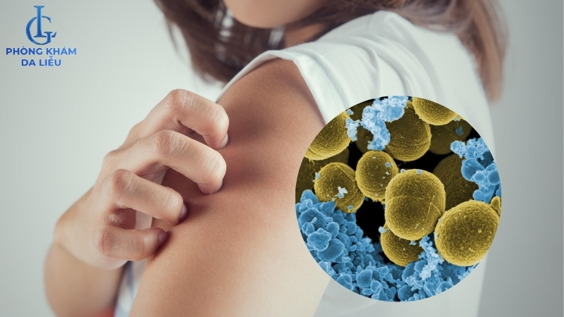 nguyên nhân gây viêm nang lông ở tay