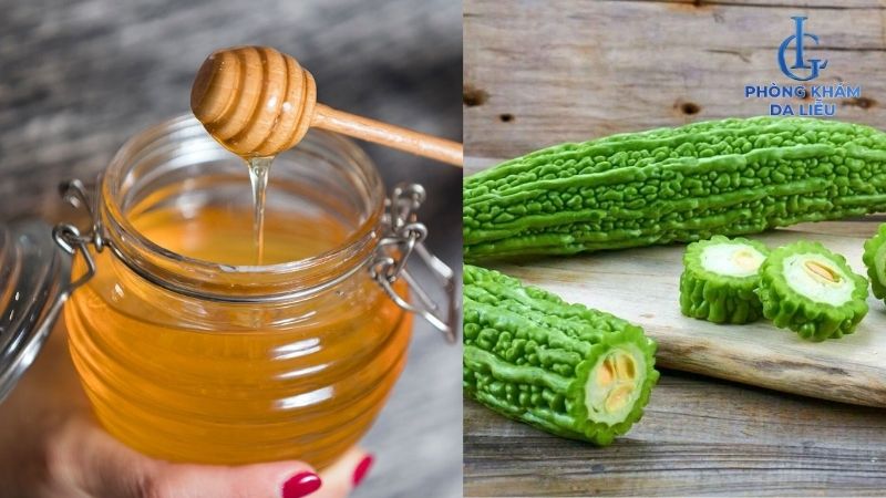 mật ong kết hợp khổ qua trị mụn