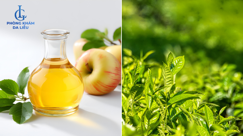 giấm táo và trà xanh trị mụn lưng