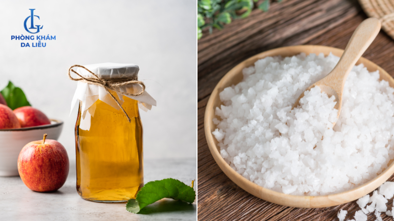 giấm táo và nước muối biển trị mụn lưng