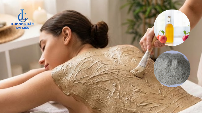 mặt nạ đất sét giấm táo trị mụn lưng