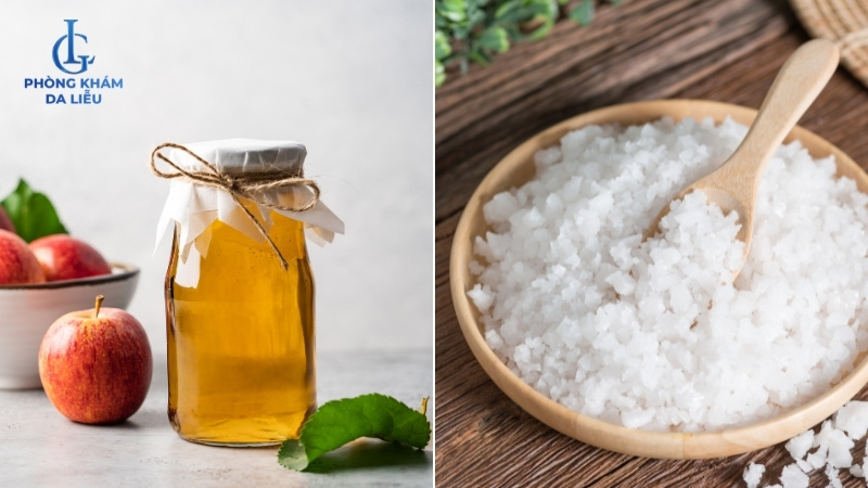 trị mụn lưng bằng giấm táo ở nhà