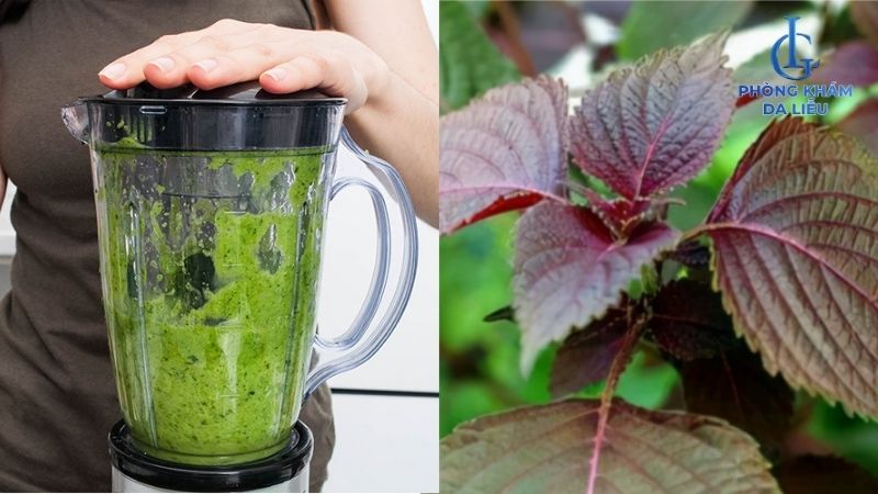 nước cốt tía tô trị mụn