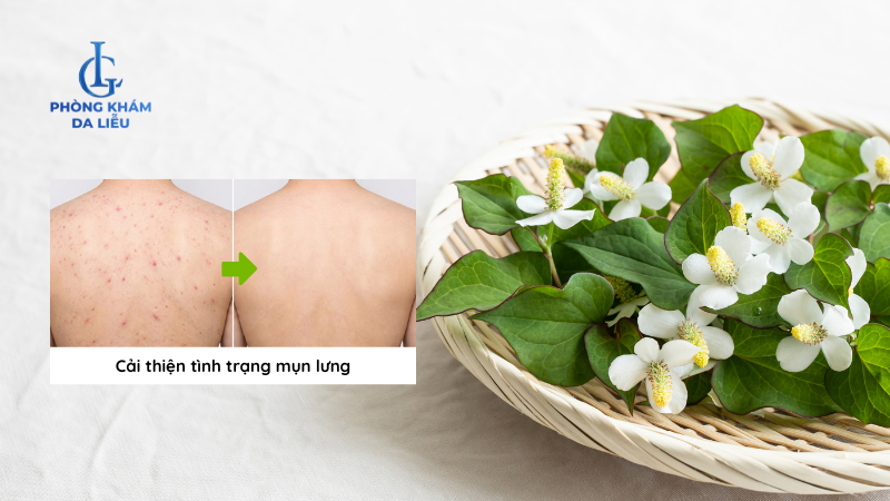 trị mụn lưng bằng rau diếp cá