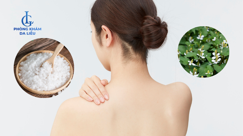 diếp cá muối biển trị mụn lưng