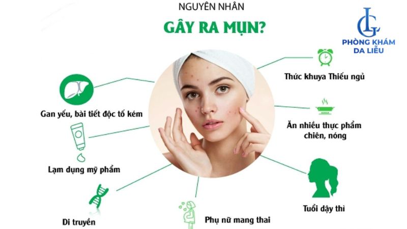 nguyên nhân gây mụn