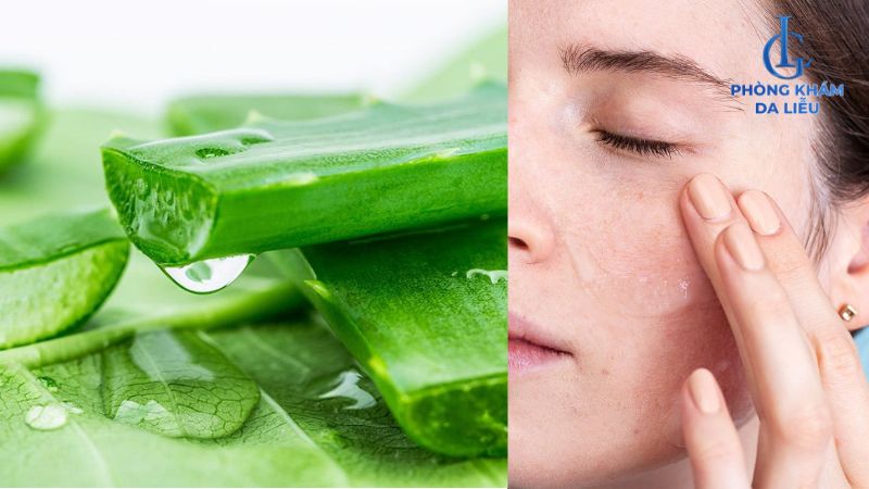 nha đam trị mụn