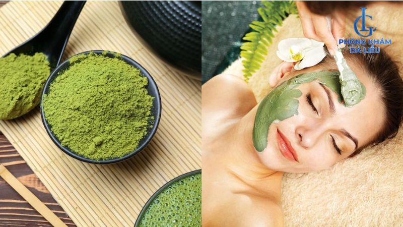 bột trà xanh trị mụn