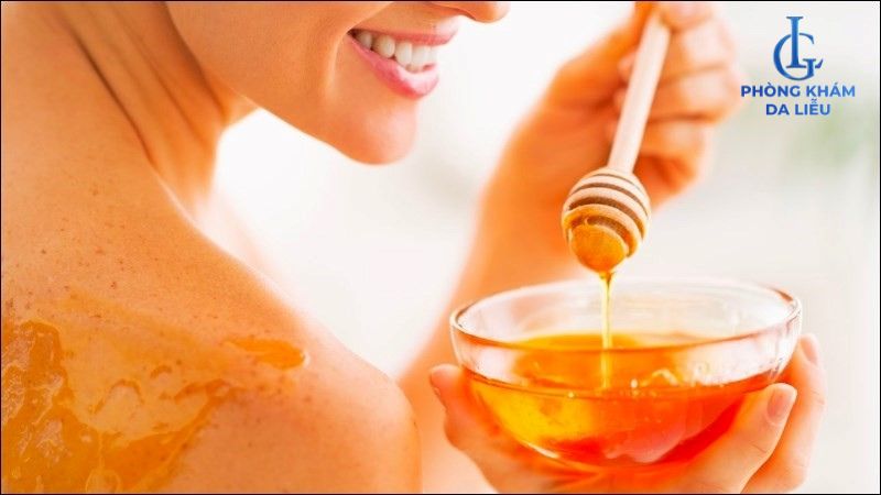 mật ong trị mụn