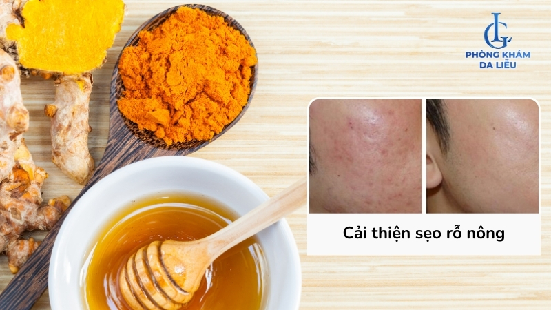 Mật ong và tin bột nghệ